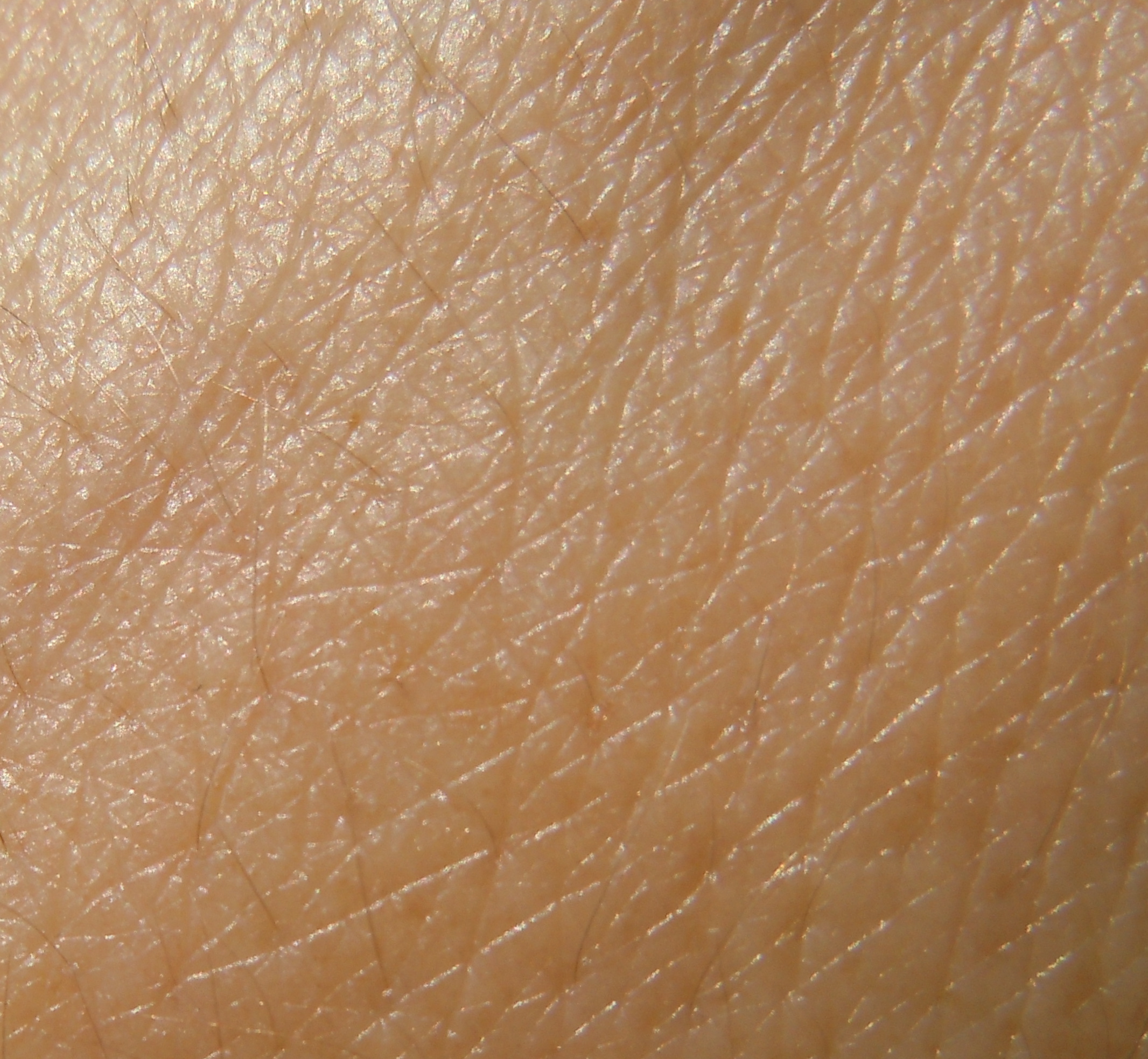 Skin before L'Occitane Hand Balm