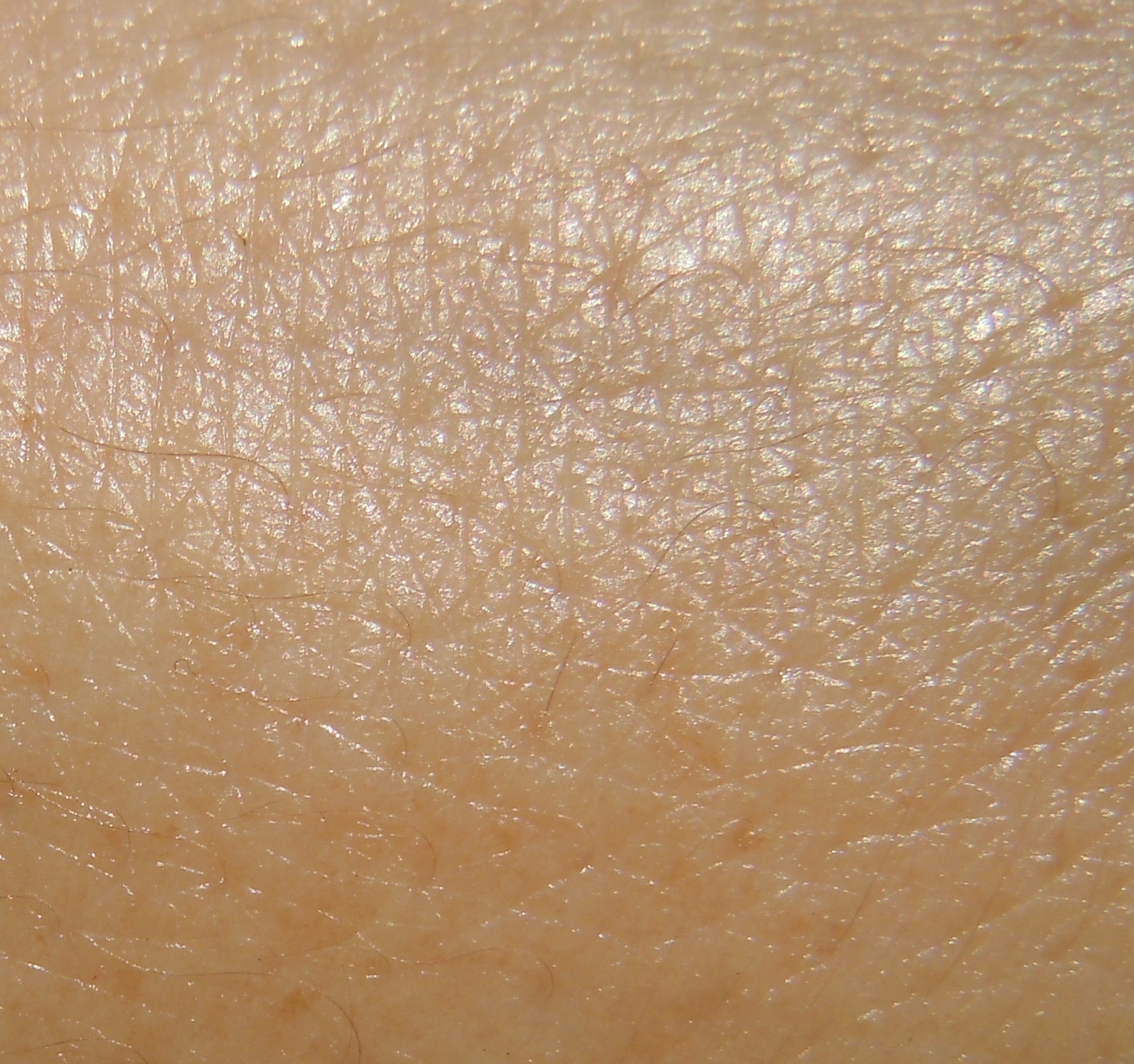 Skin after L'Occitane Hand Balm